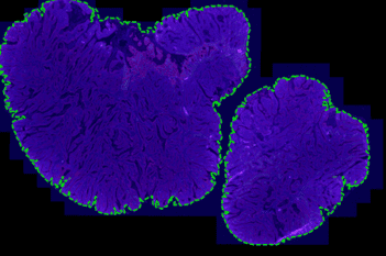 Tissue Detection, Fluorescence, 16bit