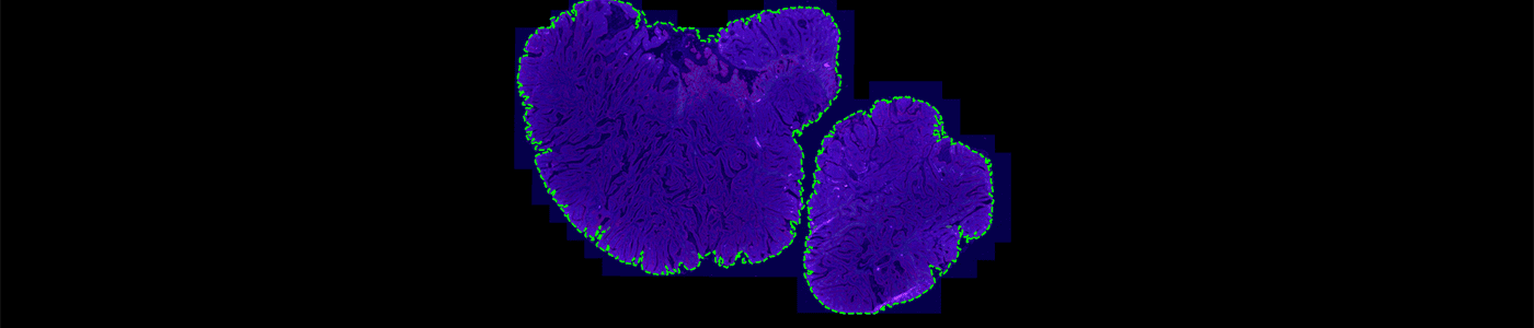Tissue Detection, Fluorescence, 16bit