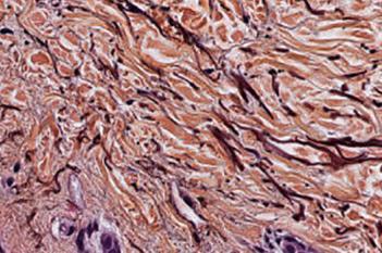 Orcein Staining, Skin