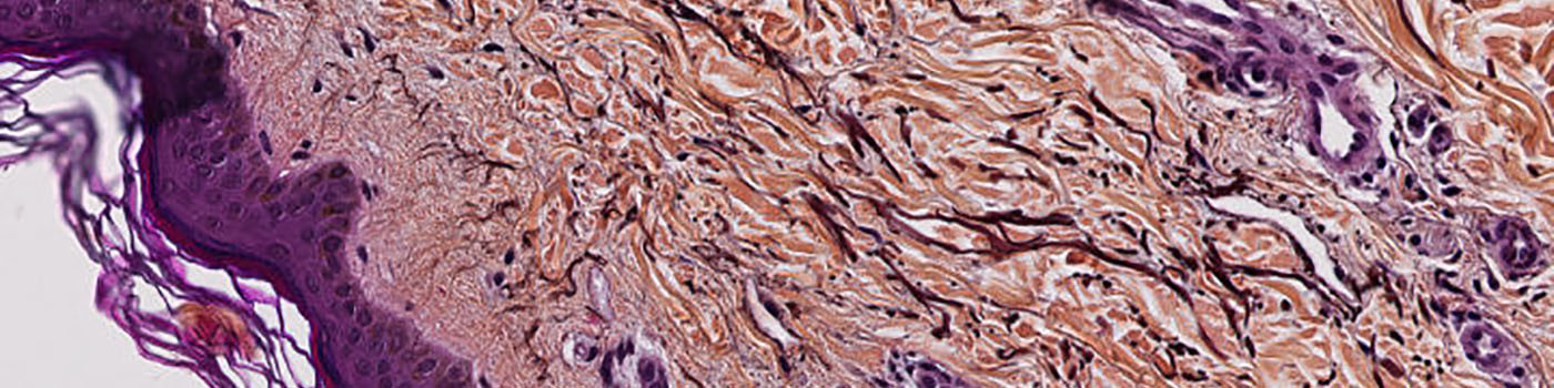 Orcein Staining, Skin