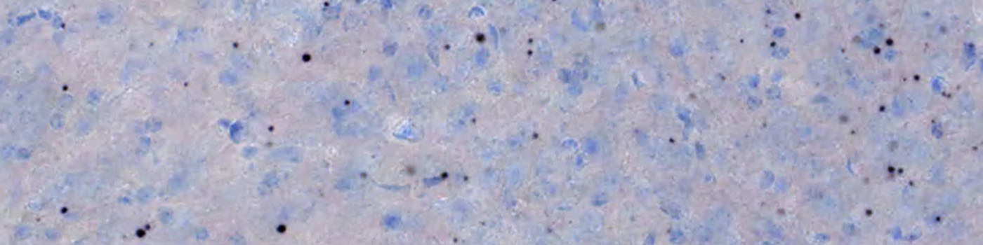 Mouse, Huntington’s Disease