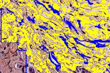 Orcein Staining, Skin