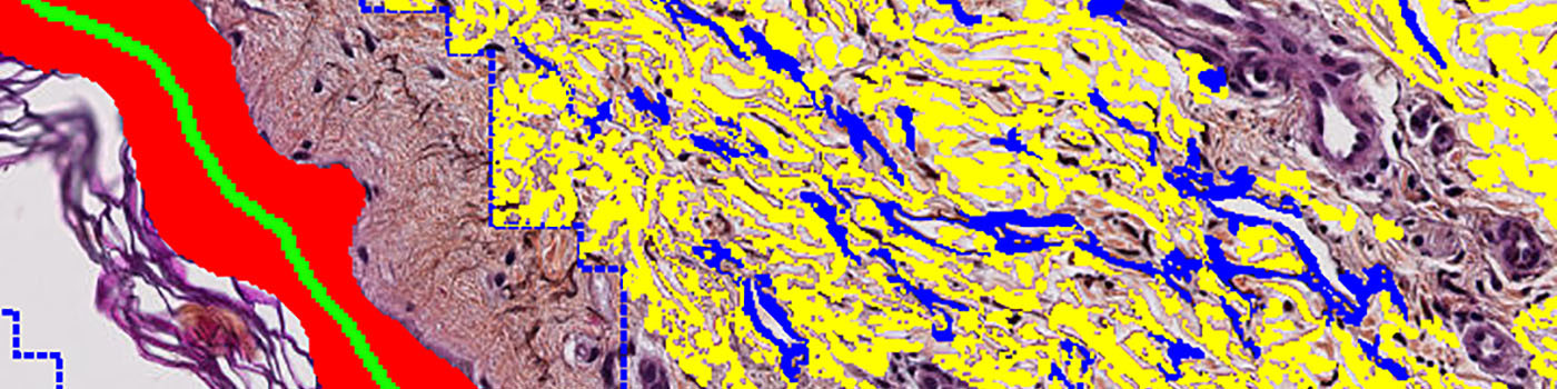 Orcein Staining, Skin