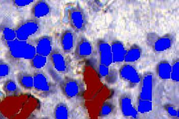 CD56, Endometrial Tissue