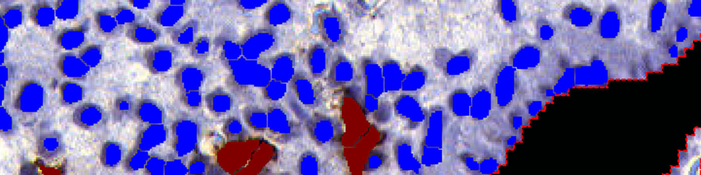 CD56, Endometrial Tissue