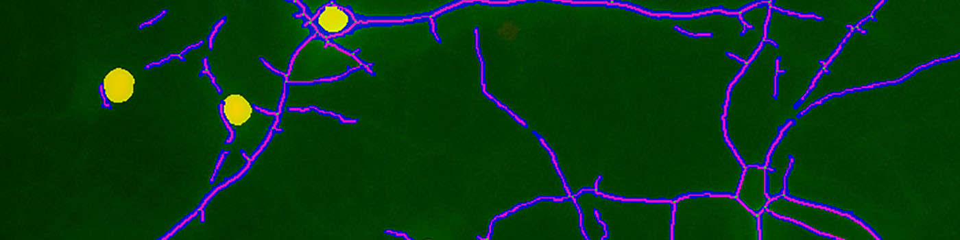 Rat, Cell Body Number and Neurite Length