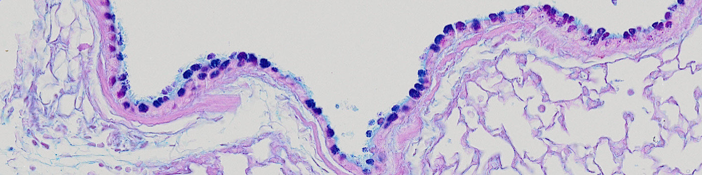 Rodent, Pulmonary MCM, AB-PAS