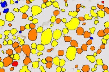 ALK, Cell Lines, Cancer