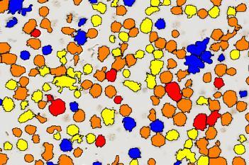 MET, Cell Lines, Cancer