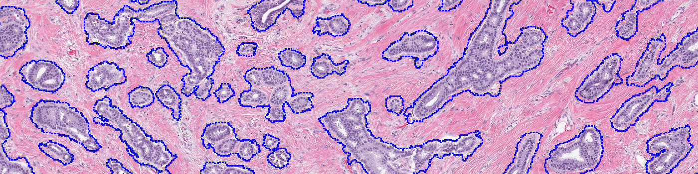 H&E, Tumor Load