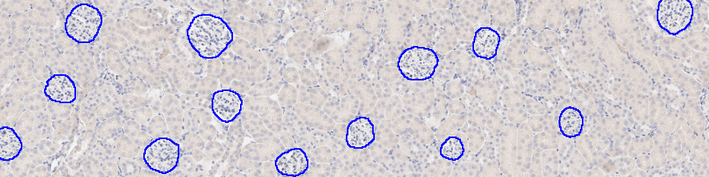 IHC, Glomeruli Detection, AI