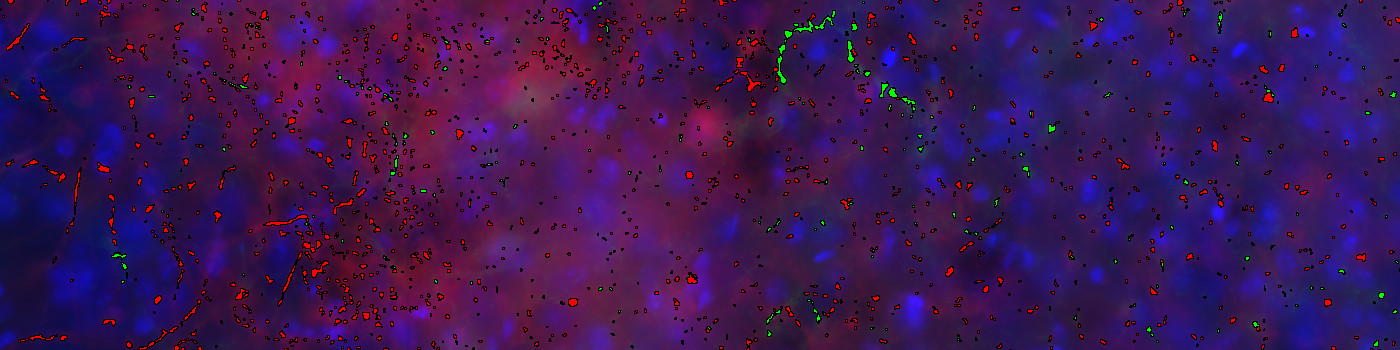 image analysis & stereology image analysis & stereology