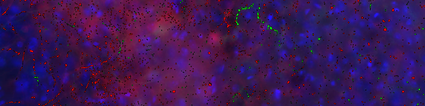 mCherry+GFP, Axon Density