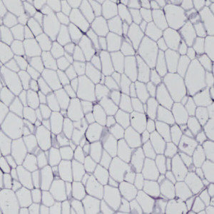 adipose tissue stereology