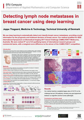 Detecting Lymph Node Metastases in Breast Cancer Using Deep Learning