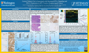 Current Tobacco Use is Associated with Decreased IFN-γ Signaling and PD-L1 Expression in HPV Positive Oropharyngeal Cancer