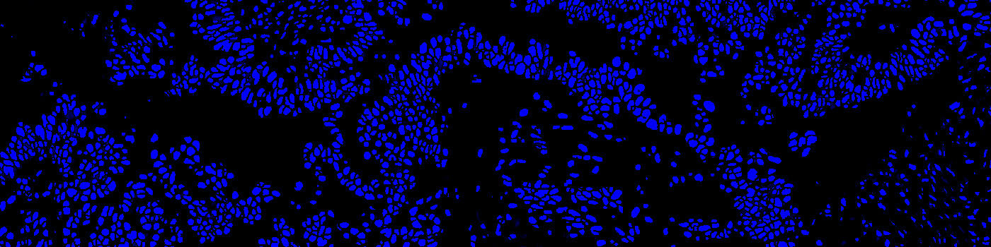 Nuclear Detection, AI (Fluorescence)