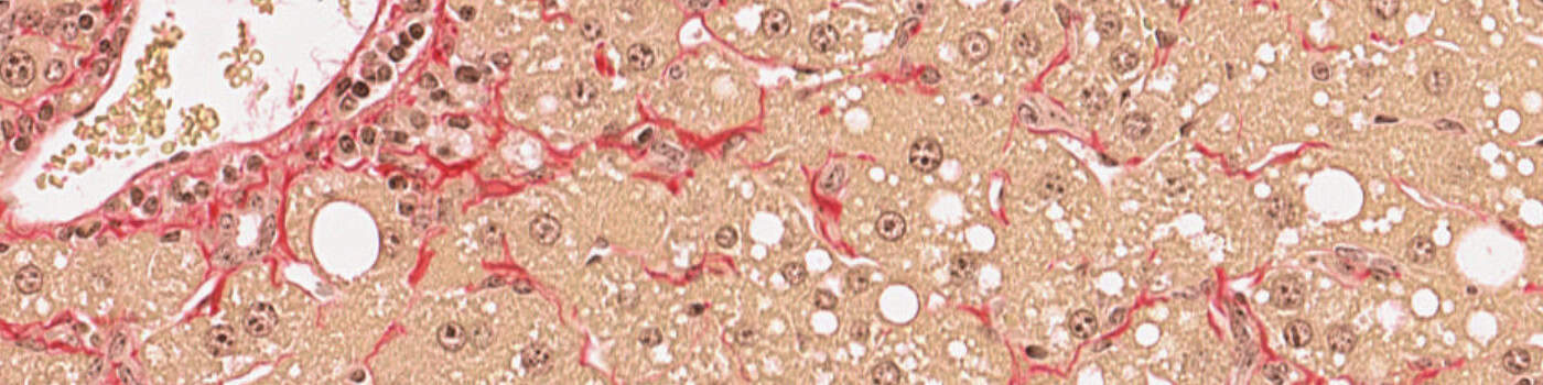 PSR, Liver Fibrosis, AI (Rodent)