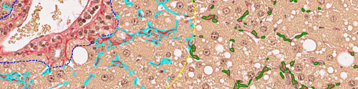 PSR, Liver Fibrosis, AI (Rodent)