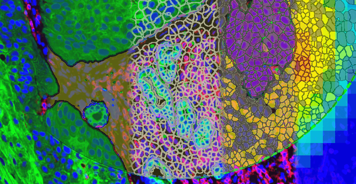 NanoString and Visiopharm announce collaboration to codevelop