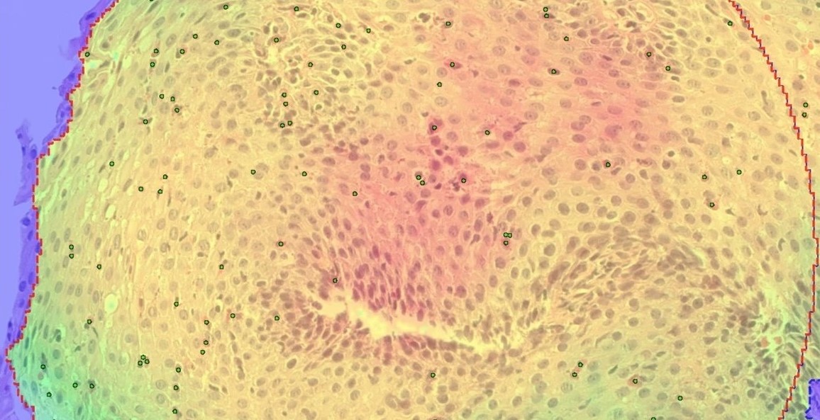 H&E-stained esophageal tissue sections Visiopharm