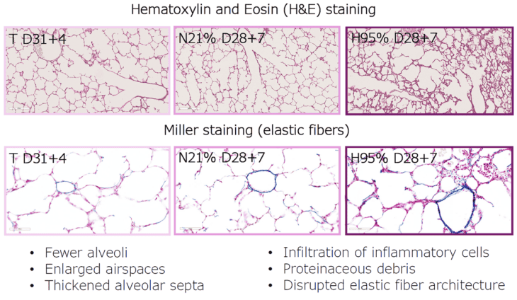Lung tissue stained with H&E and Miller methods showing alveoli and elastic fibers.