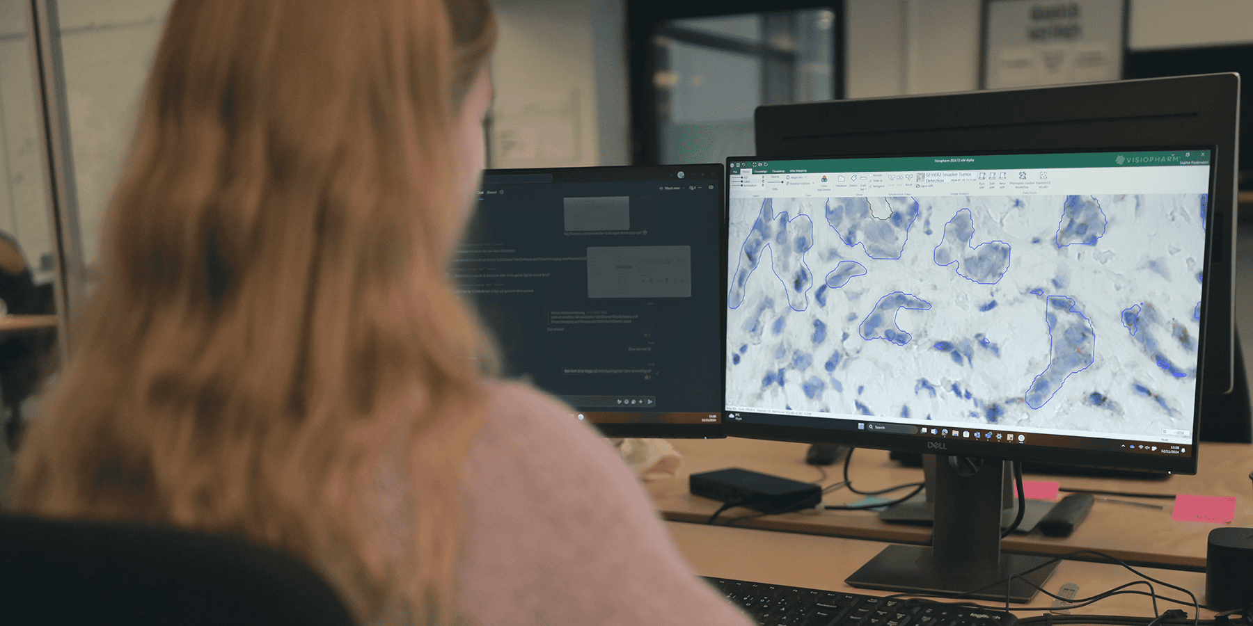 Pathology image analysis software on dual monitors with microscope image.