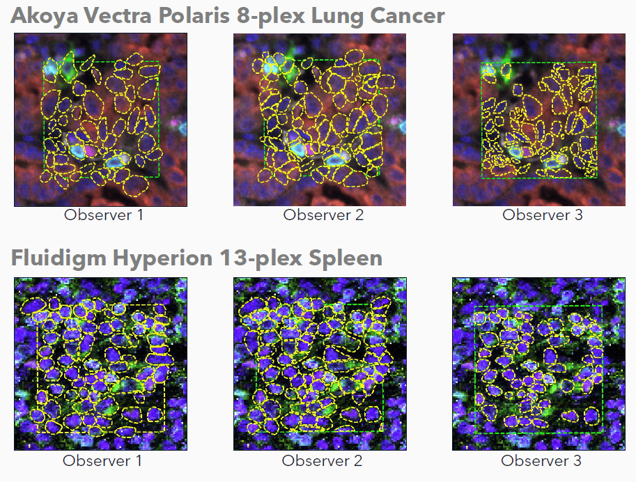 A Guide to Cell Segmentation in Multiplex Tissue Imaging with AI ...