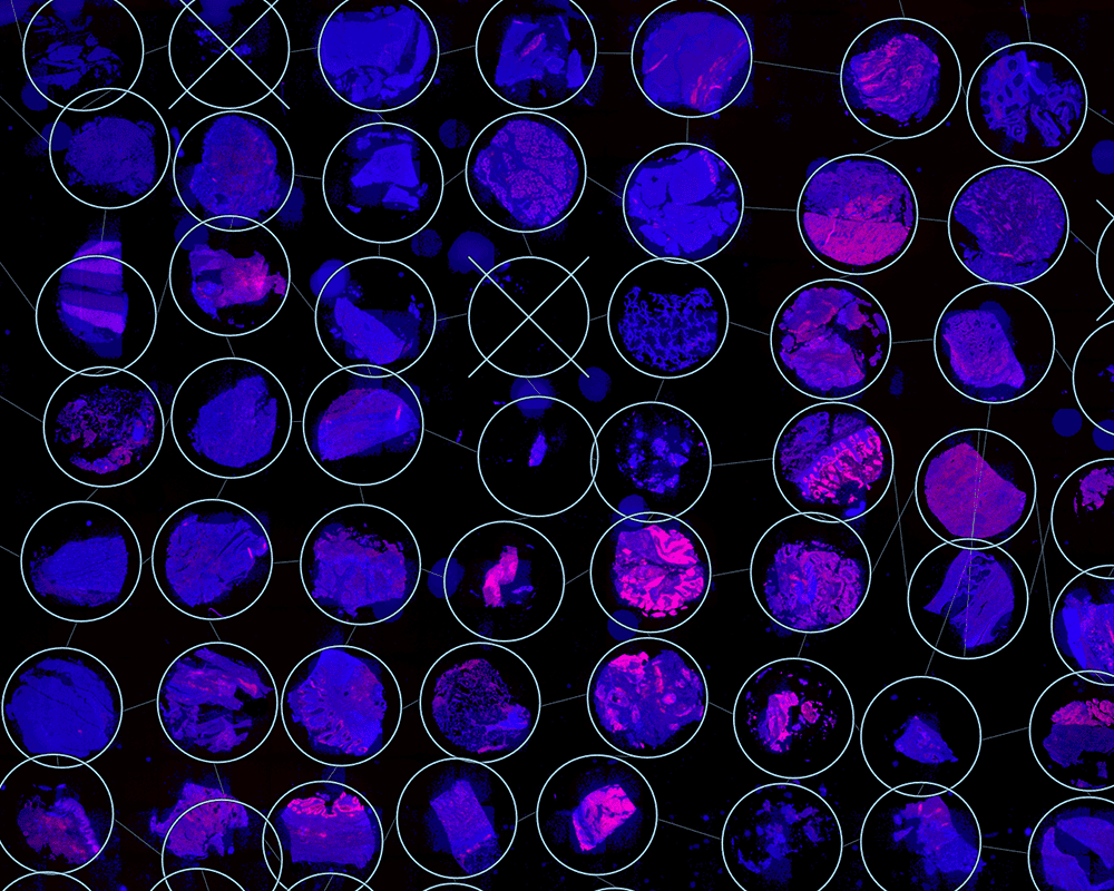 Faster, smarter, and more scalable: </br></br>Tissue Micro Array analysis” width=”1500″ height=”1200″>
               </div>
               </div>
             </div>
         </div>
			    </div>
</div>
</div>


	<div class=