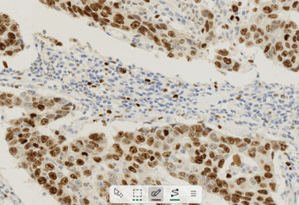 Visiopharm drawing tool