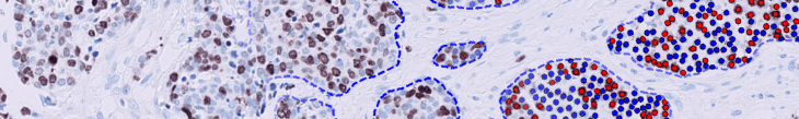 Digital pathology image showing cell analysis with AI support.