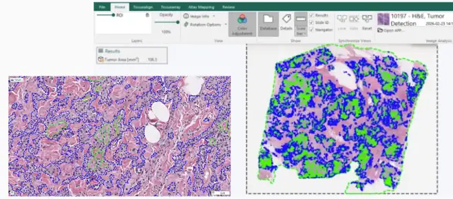Quickstart APP - H&E Tumor Detection