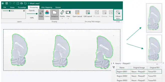 Image crops based on ROIs feature as part of Tissuearray