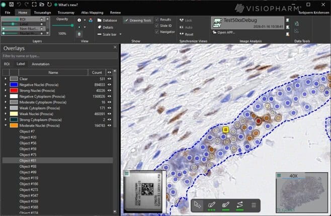 New overlay panel available in the viewer