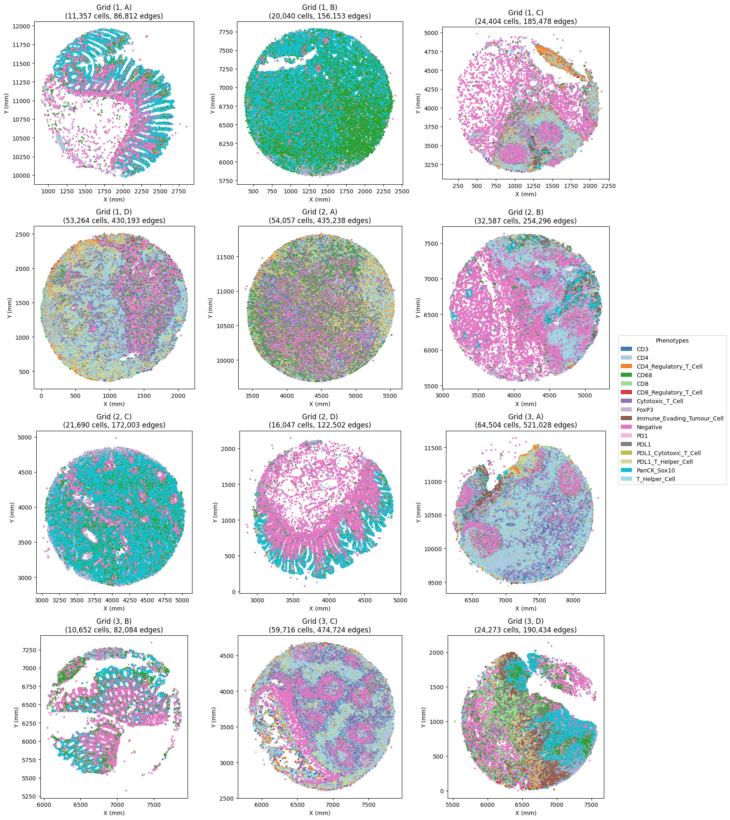 Histology tissue sample analyzed with Phenoplex™ software for biomarker detection.